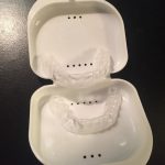 At Home Teeth Whitening: Does it Work?